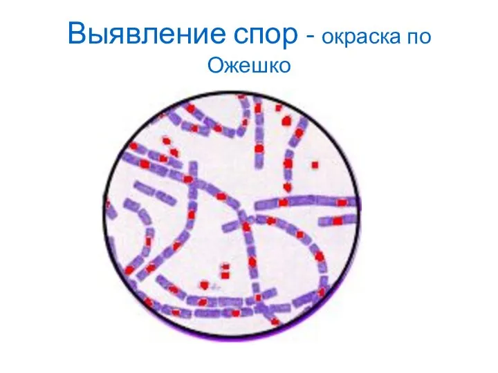 Выявление спор - окраска по Ожешко