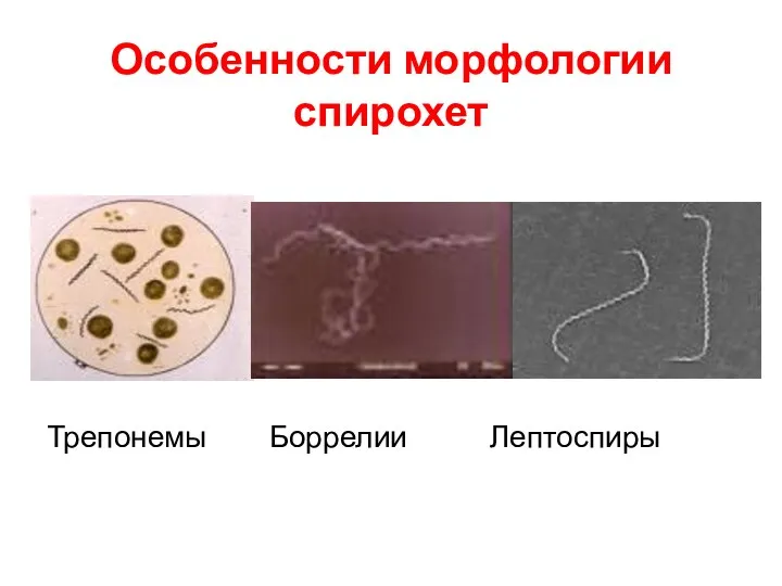 Особенности морфологии спирохет Трепонемы Боррелии Лептоспиры