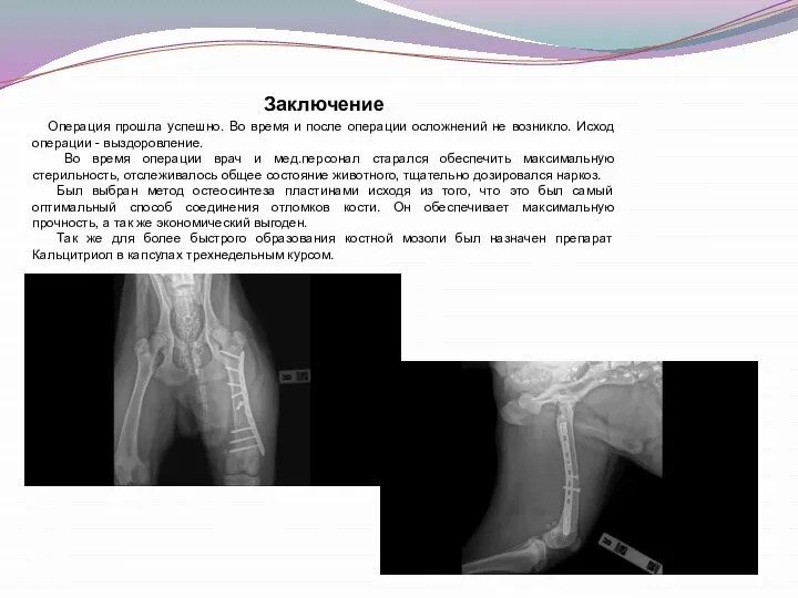 Заключение Операция прошла успешно. Во время и после операции осложнений не