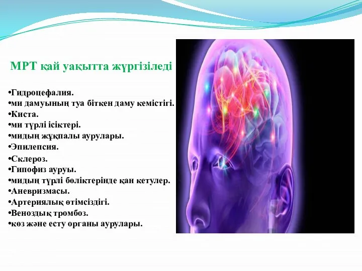 Гидроцефалия. ми дамуының туа біткен даму кемістігі. Киста. ми түрлі ісіктері.