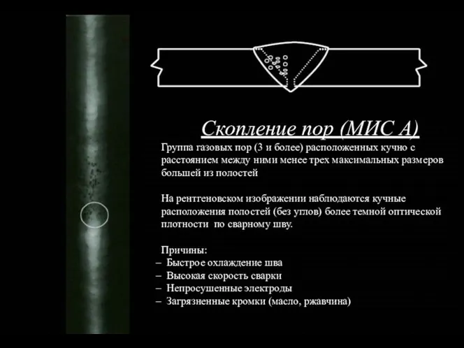 Скопление пор (МИС А) Группа газовых пор (3 и более) расположенных