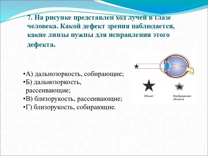 7. На рисунке представлен ход лучей в глазе человека. Какой дефект