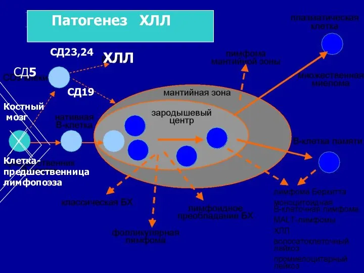 ХЛЛ СД5 Клетка-предшественница лимфопоэза Костный мозг СД19 СД23,24 Патогенез ХЛЛ