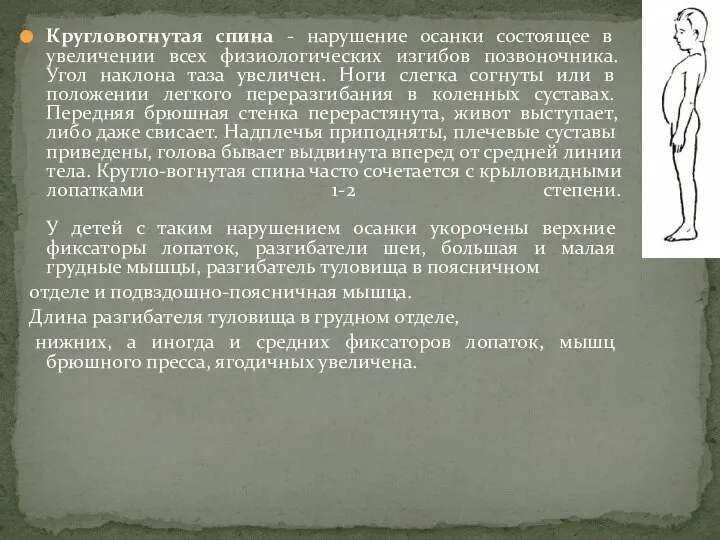 Кругловогнутая спина - нарушение осанки состоящее в увеличении всех физиологических изгибов