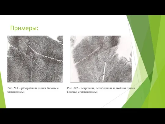 Примеры: Рис. №1 – разорванная линия Головы с замещением; Рис. №2