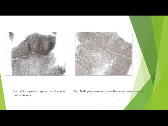 Рис. №3 – фрагментарная, ослабленная линия Головы; Рис. № 4- разорванная линия Головы, с замещением;