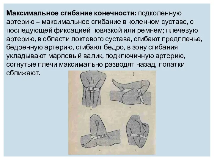 Максимальное сгибание конечности: подколенную артерию – максимальное сгибание в коленном суставе,