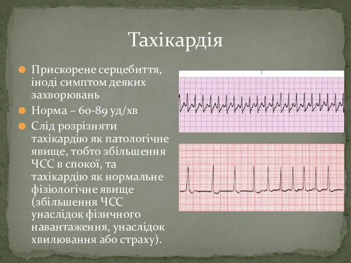 Прискорене серцебиття, іноді симптом деяких захворювань Норма – 60-89 уд/хв Слід