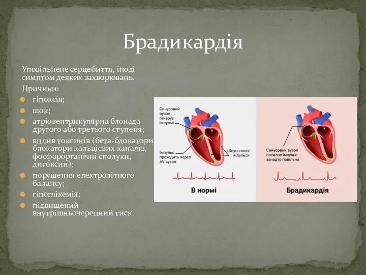 Уповільнене серцебиття, іноді симптом деяких захворювань. Причини: гіпоксія; шок; атріовентрикулярна блокада