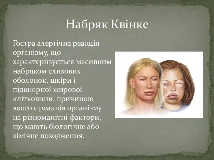 Гостра алергічна реакція організму, що характеризується масивним набряком слизових оболонок, шкіри