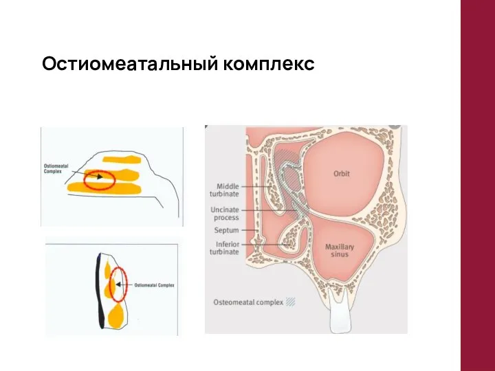 Остиомеатальный комплекс