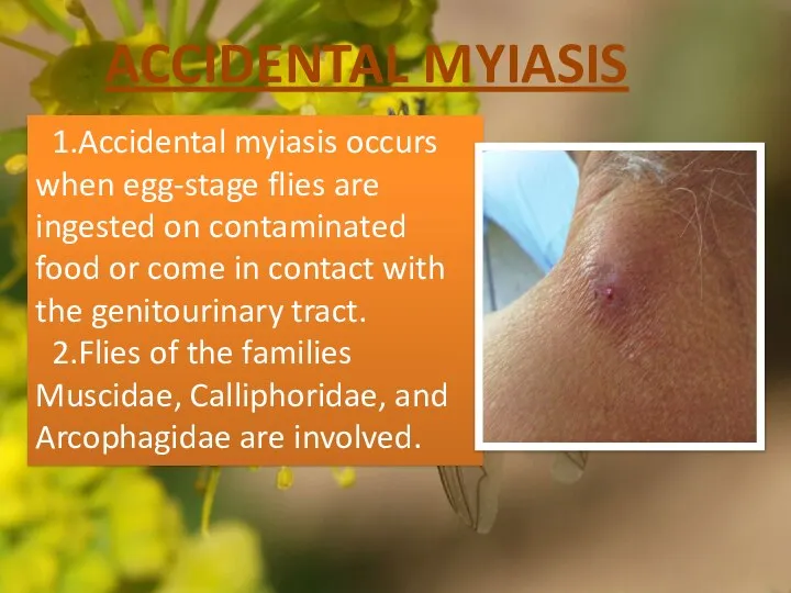 ACCIDENTAL MYIASIS 1.Accidental myiasis occurs when egg-stage flies are ingested on