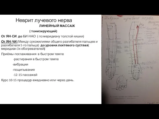 Неврит лучевого нерва ЛИНЕЙНЫЙ МАССАЖ ( тонизирующий) От ЯН-СИ до БИ-НАО