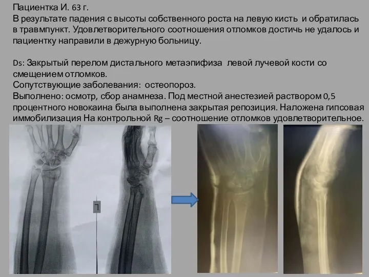 Пациентка И. 63 г. В результате падения с высоты собственного роста