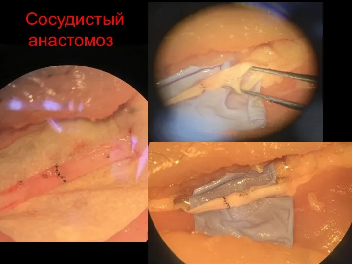 Сосудистый анастомоз?
