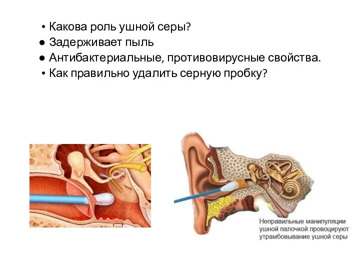 Какова роль ушной серы? Задерживает пыль Антибактериальные, противовирусные свойства. Как правильно удалить серную пробку?