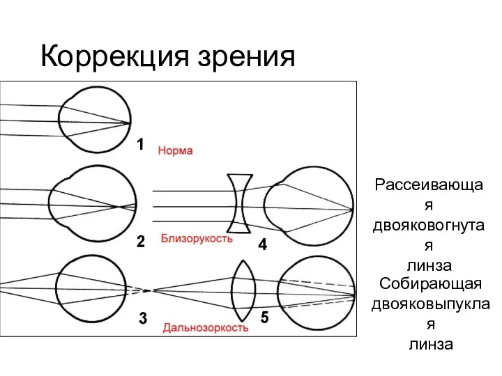 Коррекция зрения Рассеивающая двояковогнутая линза Собирающая двояковыпуклая линза