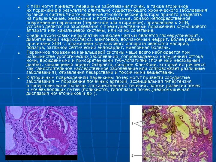 К ХПН могут привести первичные заболевания почек, а также вторичное их