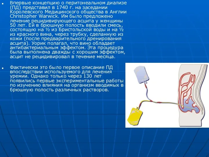 Впервые концепцию о перитонеальном диализе (ПД) представил в 1740 г. на