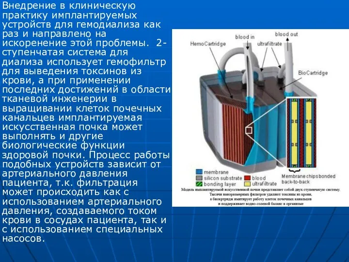 Внедрение в клиническую практику имплантируемых устройств для гемодиализа как раз и