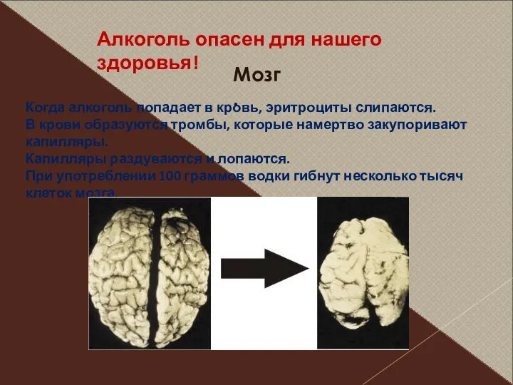 Алкоголь опасен для нашего здоровья! Мозг. Когда алкоголь попадает в кровь,