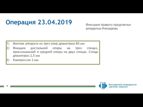 Операция 23.04.2019 Монтаж аппарата из трез опор диаметром 80 мм Фикация