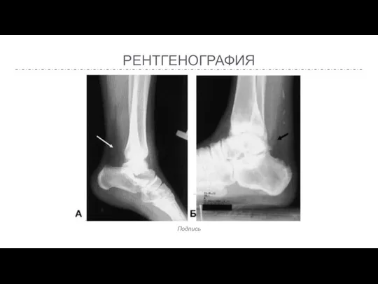 РЕНТГЕНОГРАФИЯ