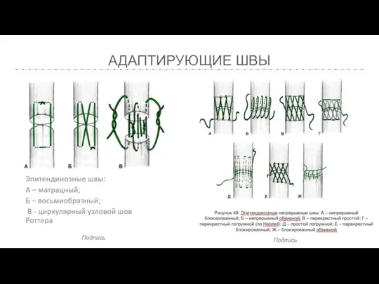 АДАПТИРУЮЩИЕ ШВЫ