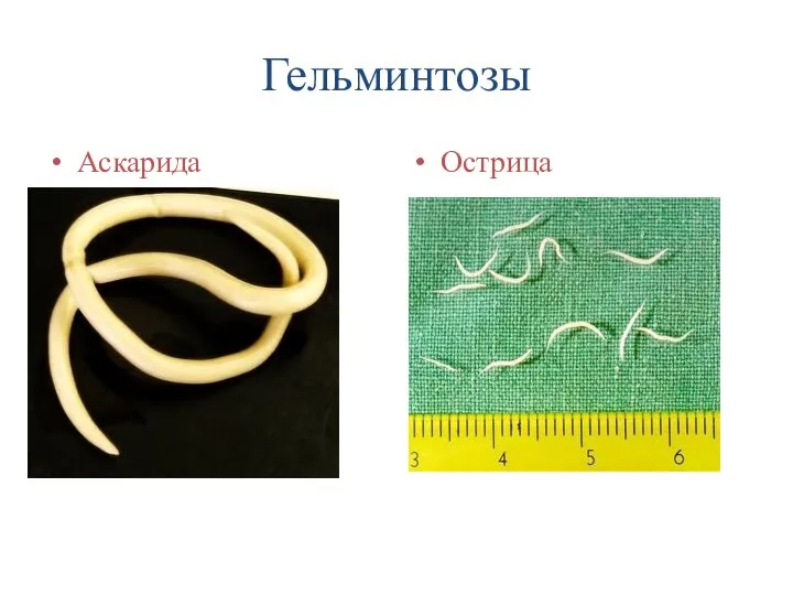 Гельминтозы Аскарида Острица