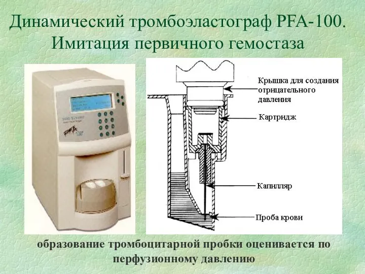 Динамический тромбоэластограф PFA-100. Имитация первичного гемостаза образование тромбоцитарной пробки оценивается по перфузионному давлению