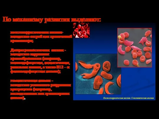 По механизму развития выделяют: постгеморрагичческая анемия-вследствие острой или хронической кровопотери; Дизэритропоэтическая