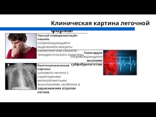 Клиническая картина легочной формы Частый «поверхностный» кашель сопровождающийся выделением мокроты слизистого