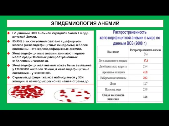 ЭПИДЕМИОЛОГИЯ АНЕМИЙ По данным ВОЗ анемией страдают около 2 млрд. жителей