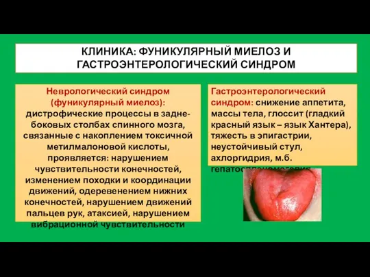 КЛИНИКА: ФУНИКУЛЯРНЫЙ МИЕЛОЗ И ГАСТРОЭНТЕРОЛОГИЧЕСКИЙ СИНДРОМ Неврологический синдром (фуникулярный миелоз): дистрофические