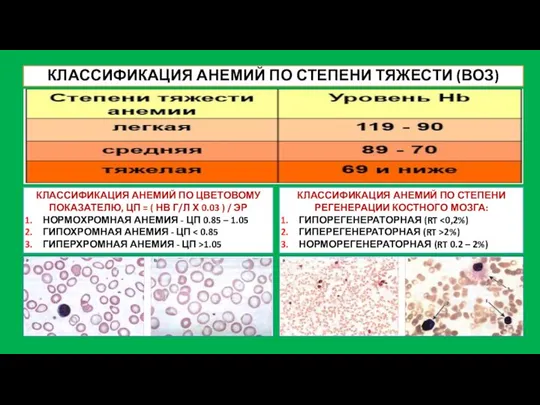 КЛАССИФИКАЦИЯ АНЕМИЙ ПО СТЕПЕНИ ТЯЖЕСТИ (ВОЗ) КЛАССИФИКАЦИЯ АНЕМИЙ ПО ЦВЕТОВОМУ ПОКАЗАТЕЛЮ,