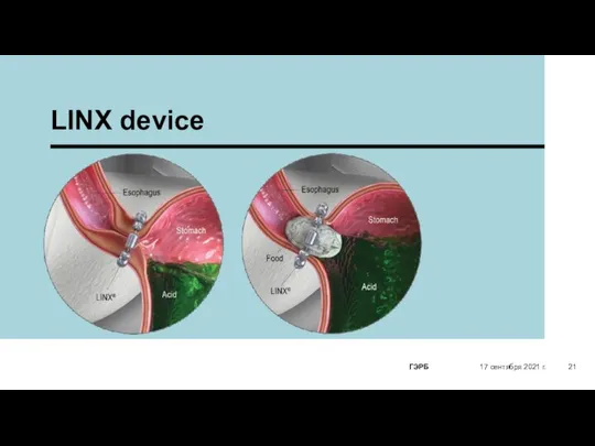 LINX device 17 сентября 2021 г. ГЭРБ