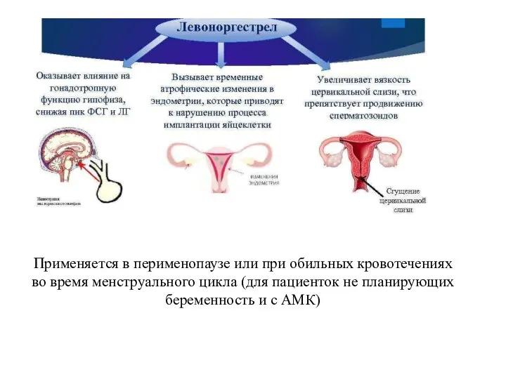 Применяется в перименопаузе или при обильных кровотечениях во время менструального цикла