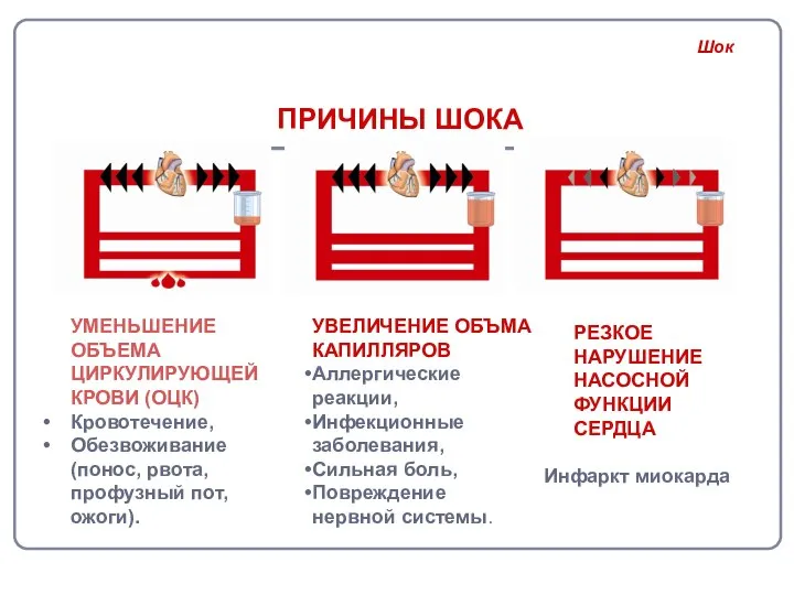 ПРИЧИНЫ ШОКА УМЕНЬШЕНИЕ ОБЪЕМА ЦИРКУЛИРУЮЩЕЙ КРОВИ (ОЦК) Кровотечение, Обезвоживание (понос, рвота,