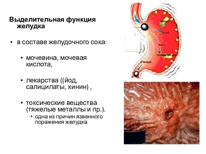 Выделительная функция желудка в составе желудочного сока: мочевина, мочевая кислота, лекарства