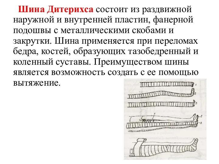 Шина Дитерихса состоит из раздвижной наружной и внутренней пластин, фанерной подошвы