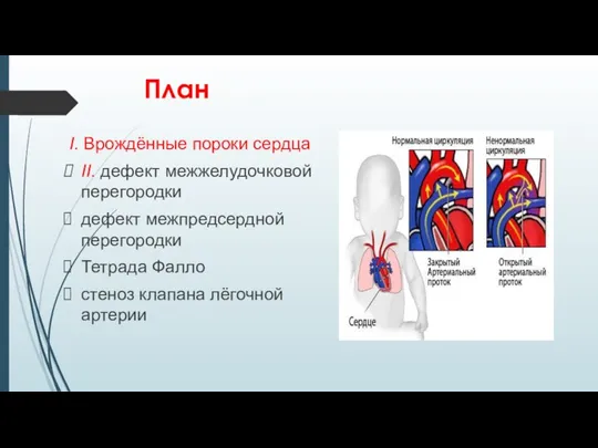 План I. Врождённые пороки сердца II. дефект межжелудочковой перегородки дефект межпредсердной