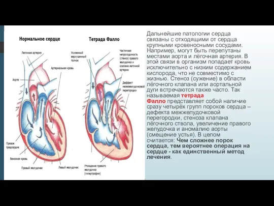 Дальнейшие патологии сердца связаны с отходящими от сердца крупными кровеносными сосудами.
