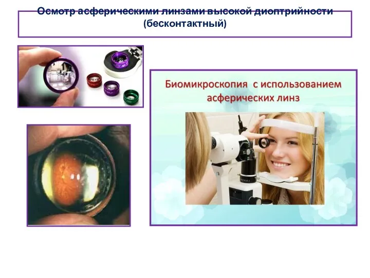 Осмотр асферическими линзами высокой диоптрийности (бесконтактный)