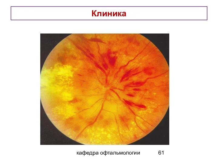 кафедра офтальмологии Клиника