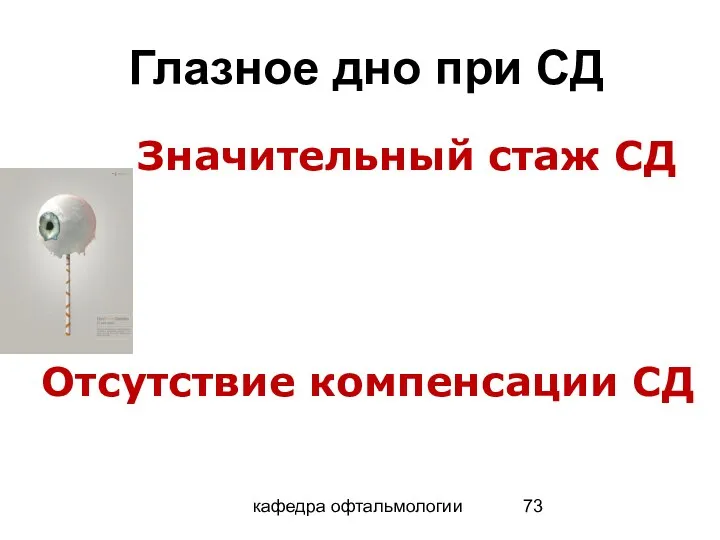 Глазное дно при СД кафедра офтальмологии Значительный стаж СД Отсутствие компенсации СД