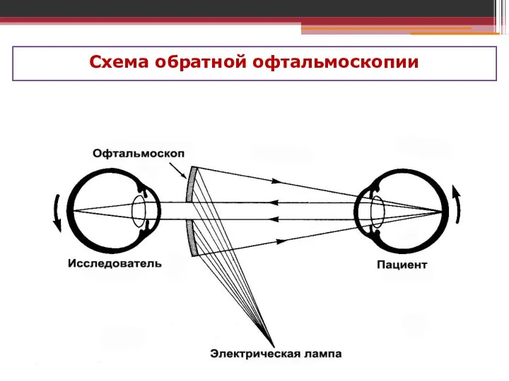 Схема обратной офтальмоскопии