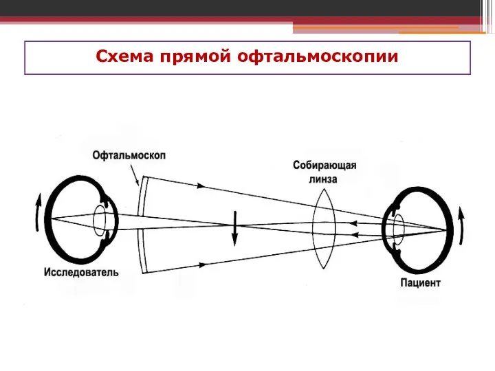 Схема прямой офтальмоскопии