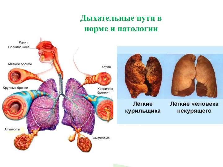 Дыхательные пути в норме и патологии