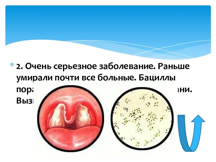 2. Очень серьезное заболевание. Раньше умирали почти все больные. Бациллы поражают