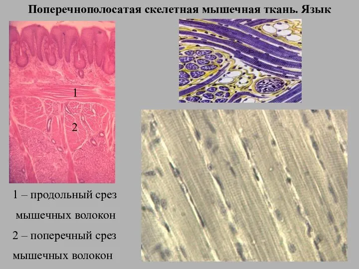 Поперечнополосатая скелетная мышечная ткань. Язык 1 – продольный срез мышечных волокон